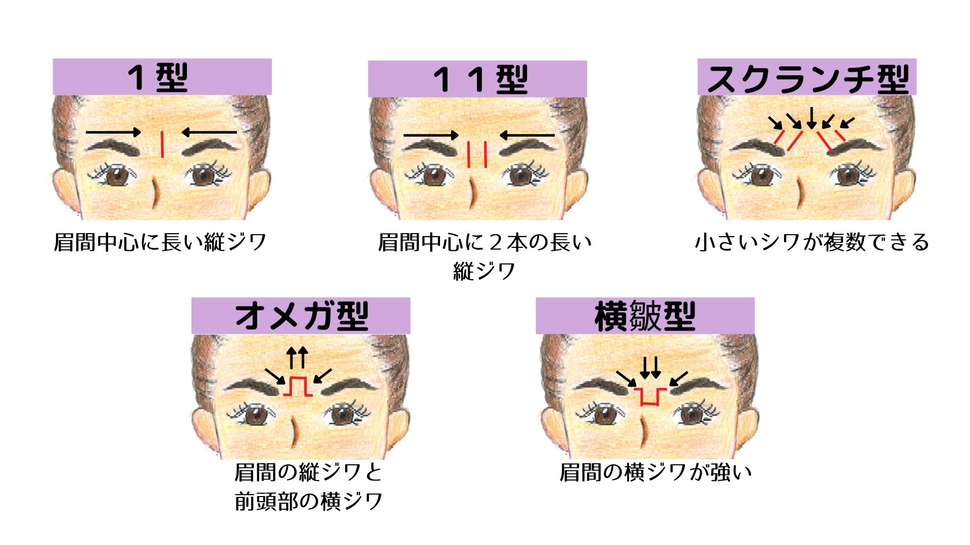 眉間ボトックスについて | 医療法人社団 美啓会 ぎふスキンケアクリニック – 岐阜市の形成外科・美容外科・美容皮膚科