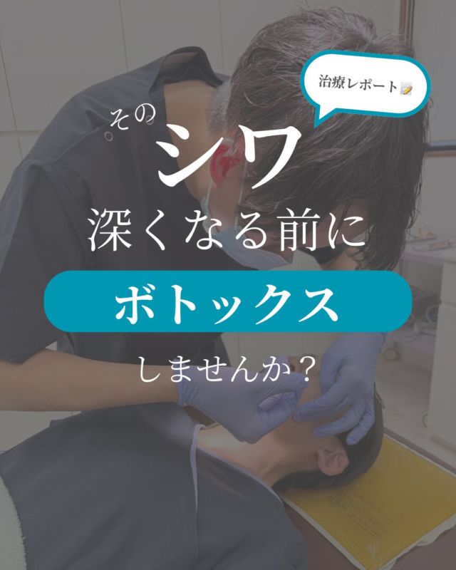 こんにちは☺️ぎふスキンケアクリニックです

先日ボトックス注射💉を新任の牧野先生に施術していただきました😌

ボトックスは表情でできるシワの改善効果がある治療で、今回は額とアゴに施術しました！
眉間や目尻にもとても人気な治療です❤️‍🩹

当院では患者様によってオーダーメイドで注射する部位や量などの調整をしているので安心して施術を受けられます☺️
ボトックスは治療の変化が分かりやすいため、逆に表情に違和感が出たりすることもありますので、クリニック選びはとても大切なんです❕

シワが寄る癖があるとだんだんシワが深くなり刻まれてしまいます😣
そうなる前に、ボトックス注射で今と未来への肌投資をしてみませんか？✨

#ぎふスキンケアクリニック #ボトックス #ボトックス効果 #美肌治療 #しわ